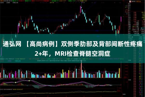 通弘网 【高尚病例】双侧季肋部及背部间断性疼痛2+年，MRI检查脊髓空洞症